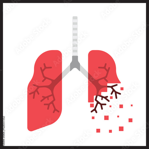 Smoker's lungs