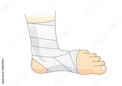 Ankle and foot with white elastic bandage for injury treatment. Illustration about first aid and medical.