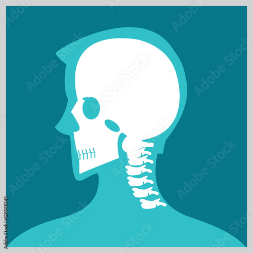 Xray of  head and neck.