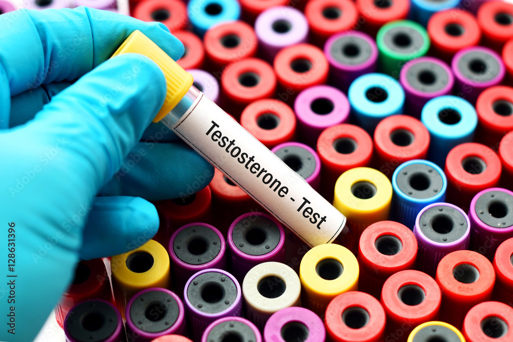 Obraz premium Testosterone hormone test