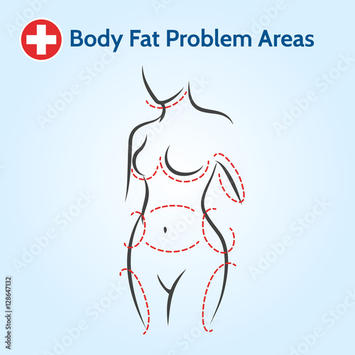 Female body fat problem areas in line style. Vector illustration