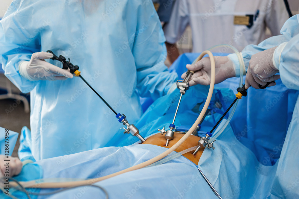 Operation Using Endoscopic Equipment Stock Photo | Adobe Stock