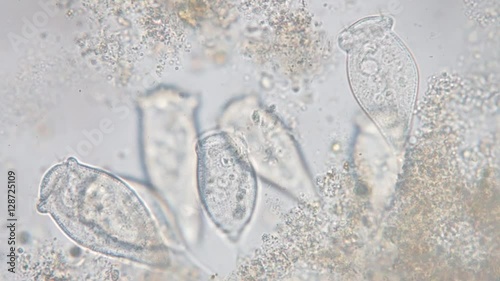 Living Vorticella is a genus of protozoan under microscope view. photo