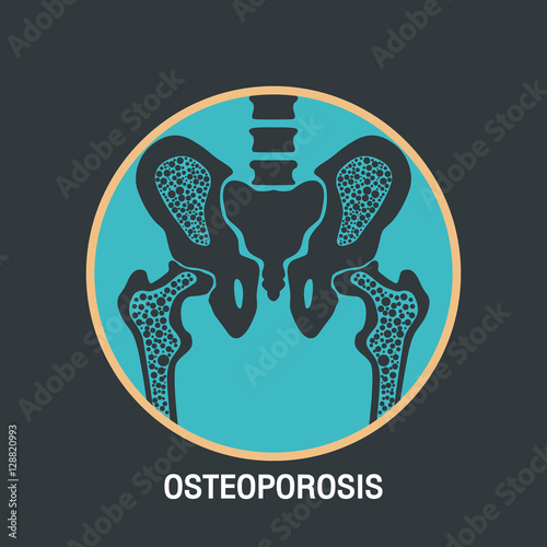 OSTEOPOROSIS vector logo icon design