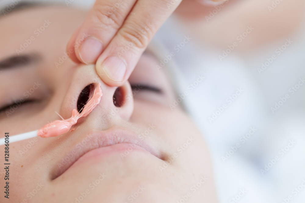 Nose waxing.Nose hair removal with hot wax Nose waxing.Nose hair removal with hot wax
