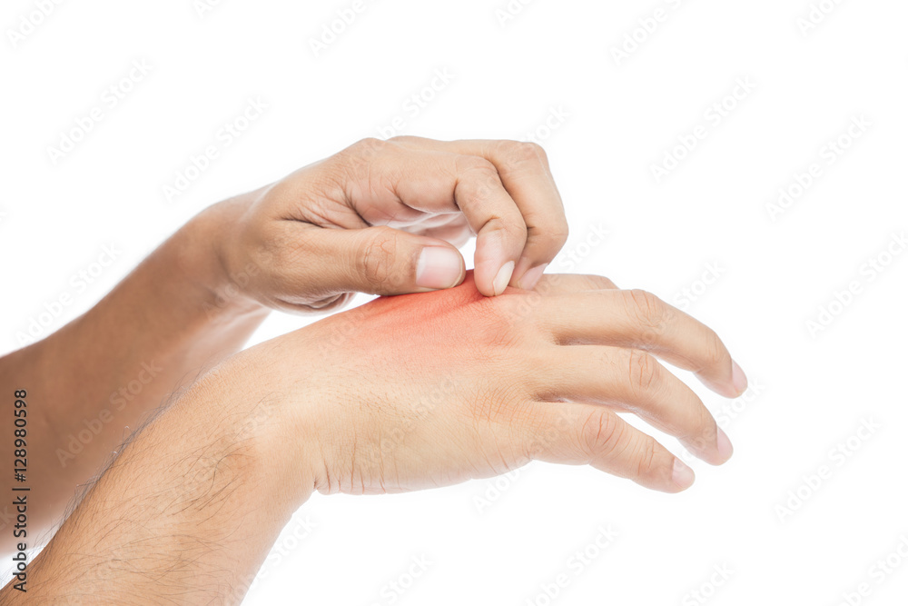 People scratch the itch with hand. itching, Concept with Healthc People scratch the itch with hand. itching, Concept with Healthc