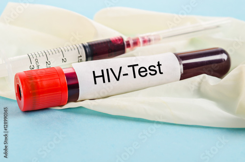 Sample blood for screening test for HIV test.