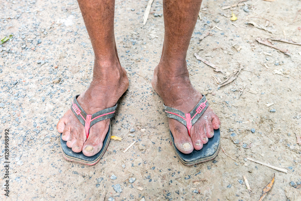 Legs of a labor with muddy Legs of a labor with muddy