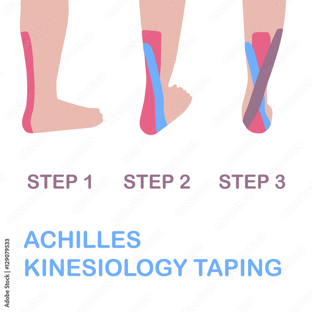 Achilles kinesiology taping. Vector illustration. Stock Vector | Adobe Stock