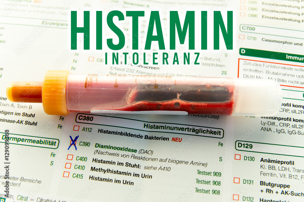 Foto de Blutabnahme bei Histaminintoleranz / Blutröhrchen zum bestimmen der Blutwerte bei