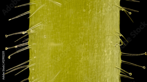 Extreme magnification - Pelargonium, Glandular hairs and tector  at 20x