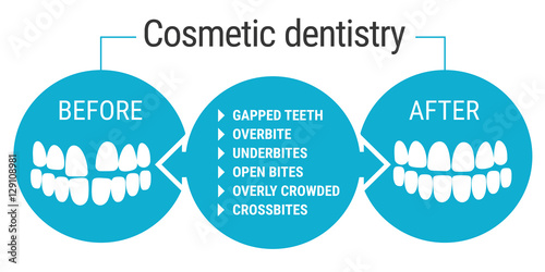 cosmetic dentistry before after. Medical infografics: Dental services. Cosmetic dentist before and after. Dental design over white background vector illustration