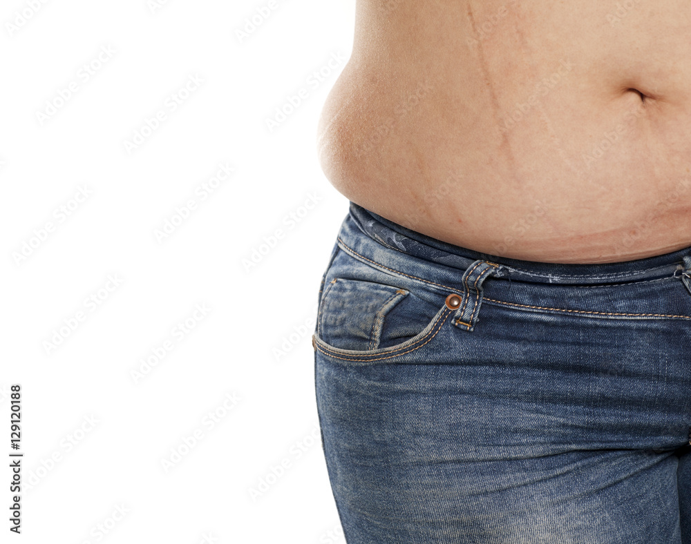Stretch lines on jeans discount