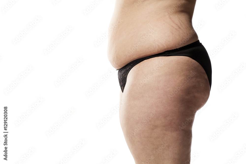 stretch marks and cellulite of a fat woman in black panties on a white  background Stock Photo | Adobe Stock
