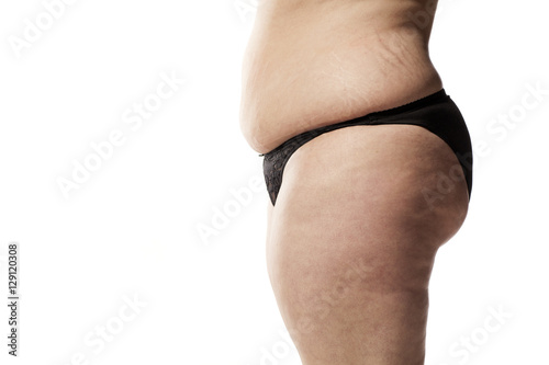 stretch marks and cellulite of a fat woman in black panties on a white background