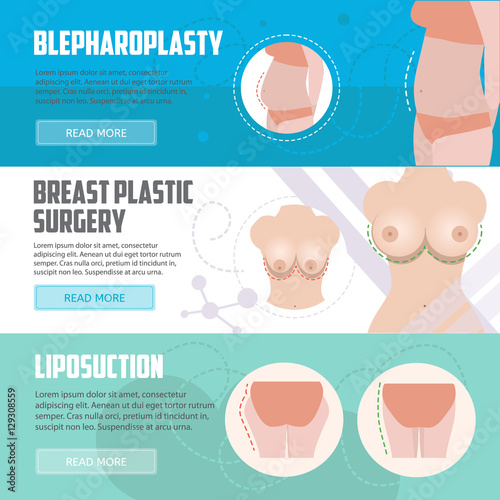 Plastic surgery horizontal banners set. Blepharoplasty, breast surgery and liposuction banners. Vector illustration for surgery clinic, hospitals and advertisement. Body correction icons.