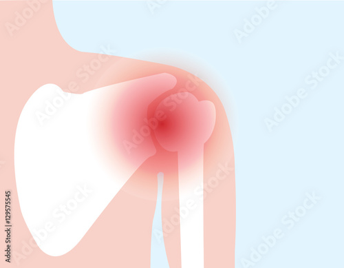 illustration vector of shoulder bone and joint pain