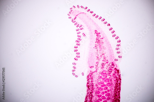 Flukes infestation (parasite) under microscope view. photo