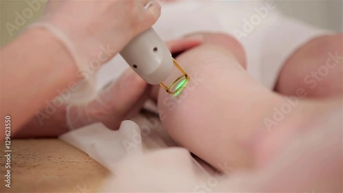 laser hair removal procedure of female legs. doctor in gloves.