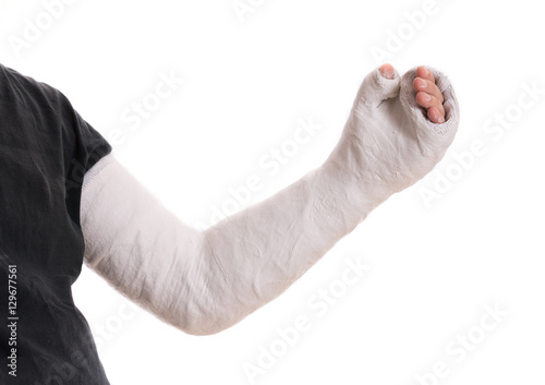 Young man wearing a long arm plaster / fiberglass cast