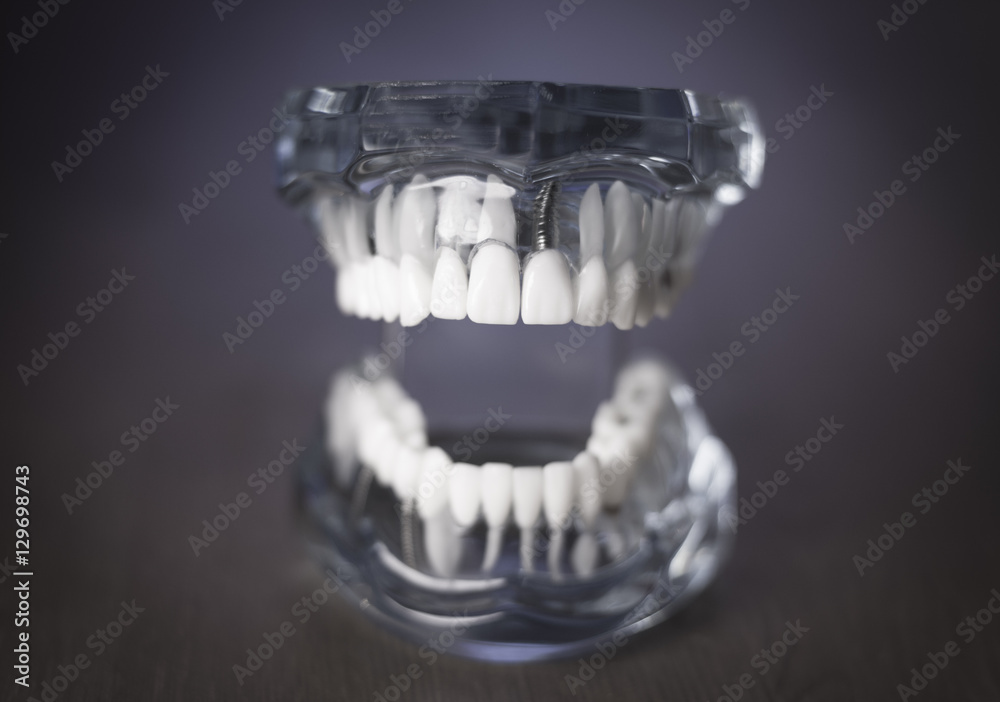 Denture for dentistry students Denture for dentistry students