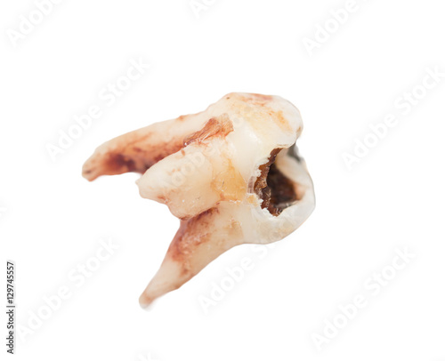 extracted tooth on a white background