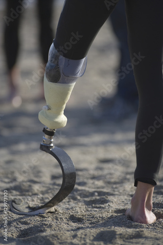 Person with prosthetic leg