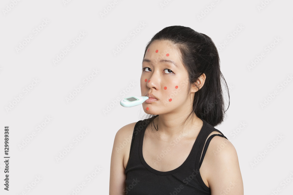 Woman with thermometer in mouth suffering from measles Woman with thermometer in mouth suffering from measles