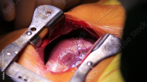 Human heart beating close-up during the surgery (1080p, 25fps)