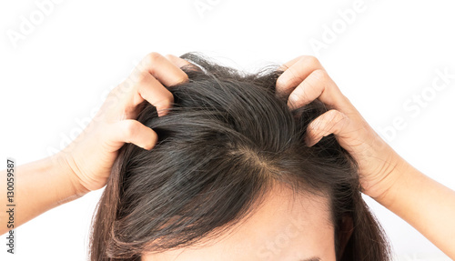 Foto Closeup woman hand itchy scalp, Hair care concept