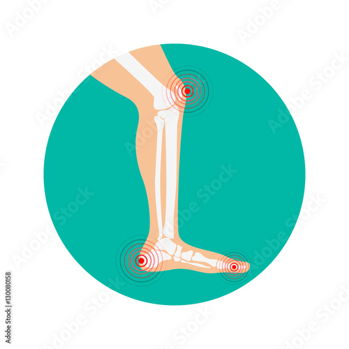 Human leg pain zones. Design elements for infographic. Vector illustration.