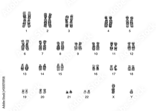 Chromosome photo