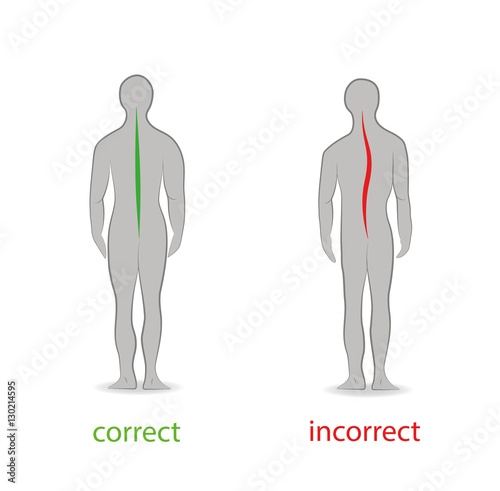 Correct alignment of human body in standing posture for good personality and healthy of spine and bone. Health care and medical illustration