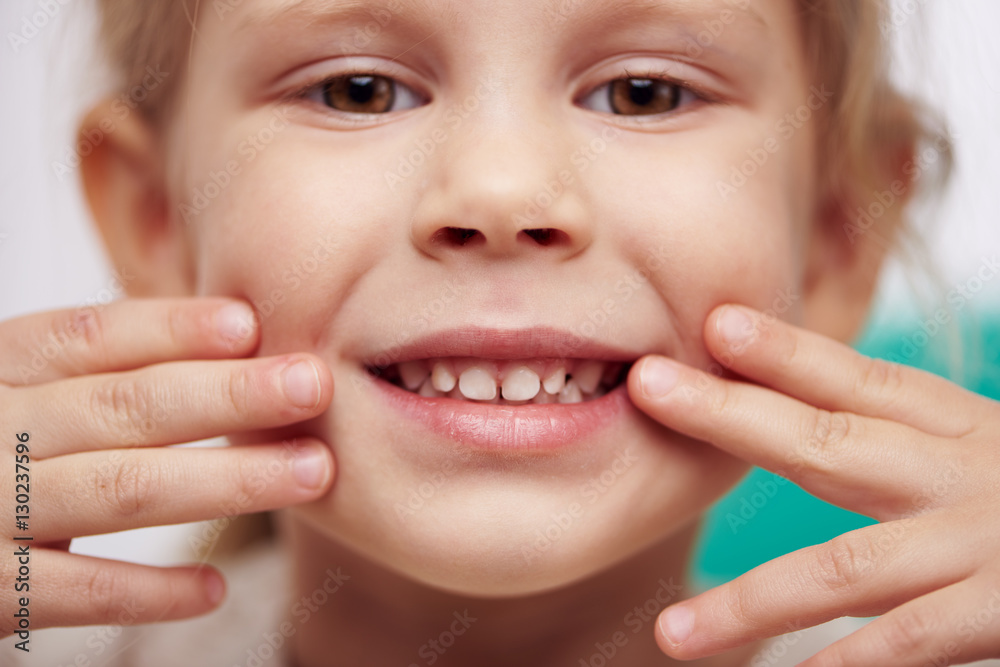 Cute little child with perfect toothy smile. Concept of teeth cure and cavity protection. Cute little child with perfect toothy smile. Concept of teeth cure and cavity protection.