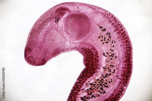 Echinostoma revolutum (parasite) under the microscope photo