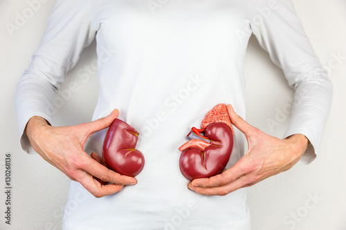 Woman holding model kidney halves at body