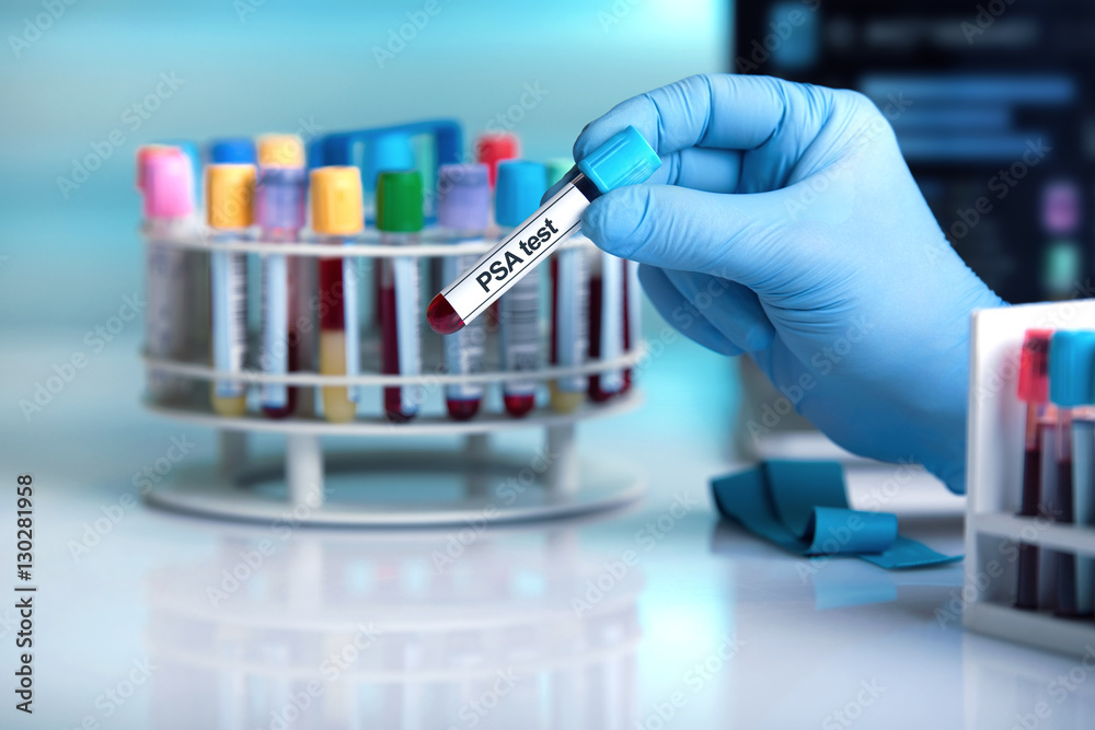 doctor holding tube with text PSA test / blood sample in tube labeled with text PSA test (Prostate Specific Antigen)  