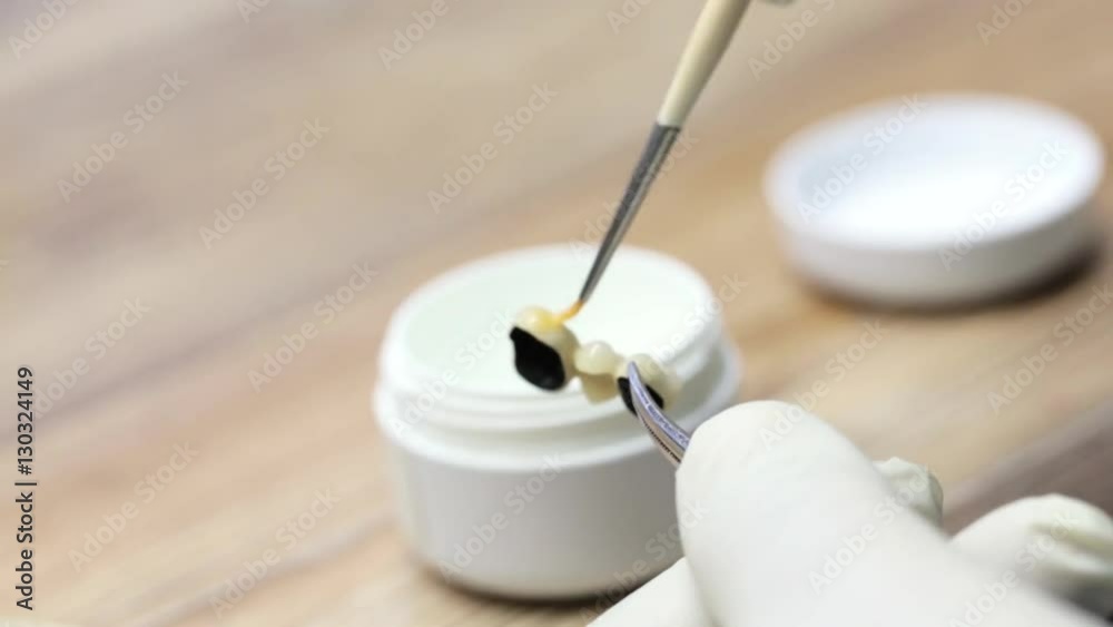 Close-up of ceramet implant creature process at laboratory. Technician cover implant of acrilic. Close-up of ceramet implant creature process at laboratory. Technician cover implant of acrilic.