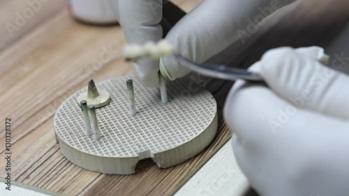 Close-up of ceramet implant creature process at laboratory. photo