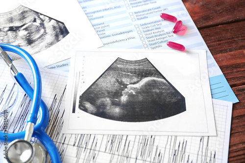 Ultrasound scan of baby and stethoscope, closeup photo