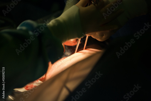 Close up image of a team of doctors delivering a baby via Caesarean section in an operating theatre in a hospital during the act of child birth