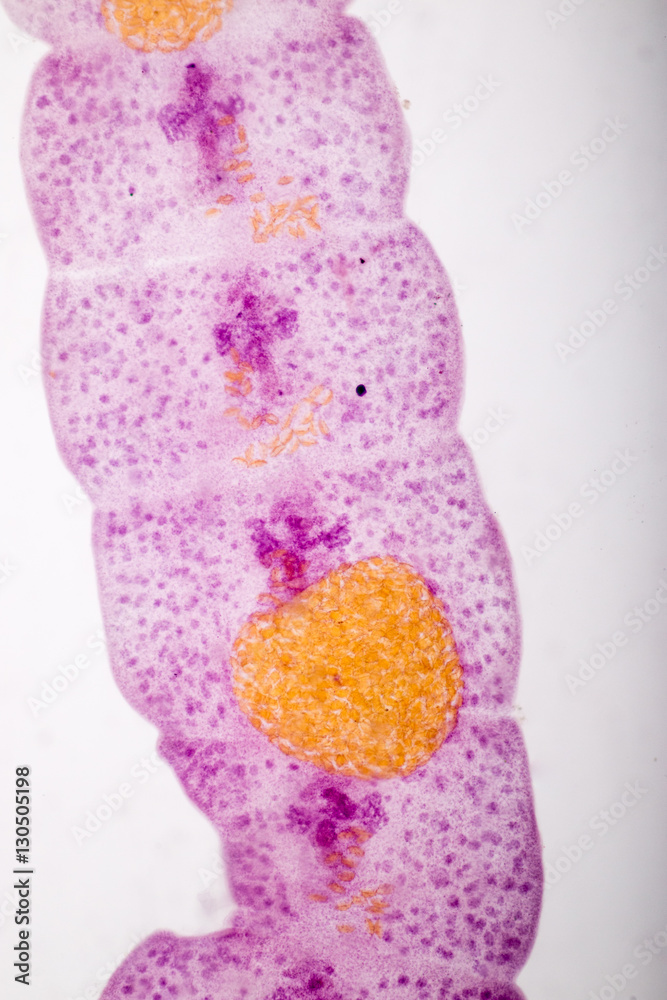 Senga Chiangmaiensis parasite on slide under microscope view. Stock ...