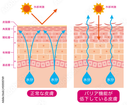 皮膚構造 乾燥肌 断面図 Stock イラスト Adobe Stock 皮膚構造 乾燥肌 断面図 Stock イラスト Adobe Stock