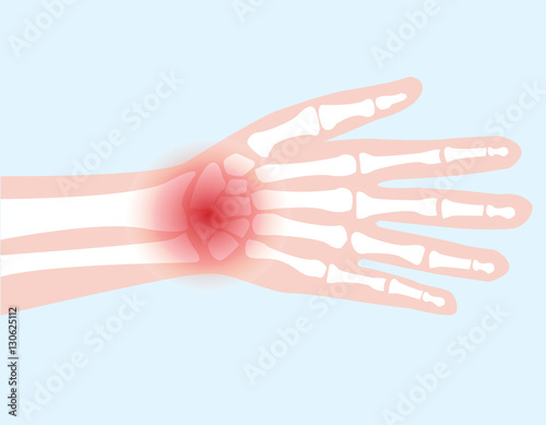 hand bone joint injured