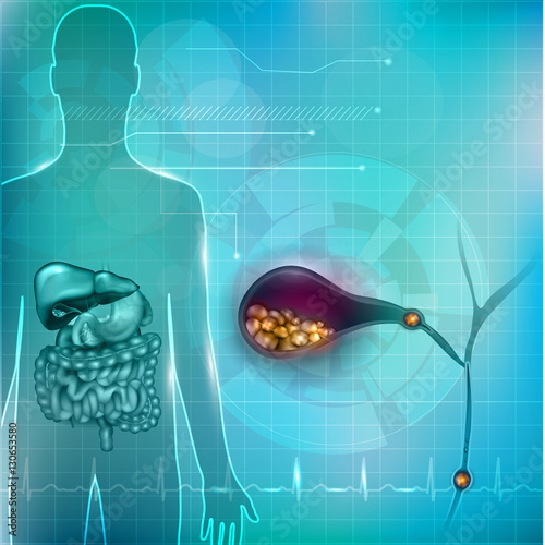Stones in the Gallbladder and human silhouette with surrounding organs bright detailed illustration on an abstract technology mesh background and light cardiogram