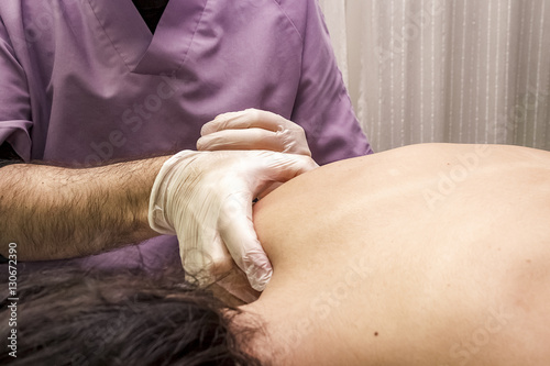 Fisioterapeuta aplicando punción en seco. Tratamiento de sobrecarga muscular.