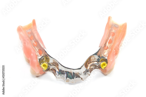 Partial denture bottom side - dental prosthetics isolated on whi