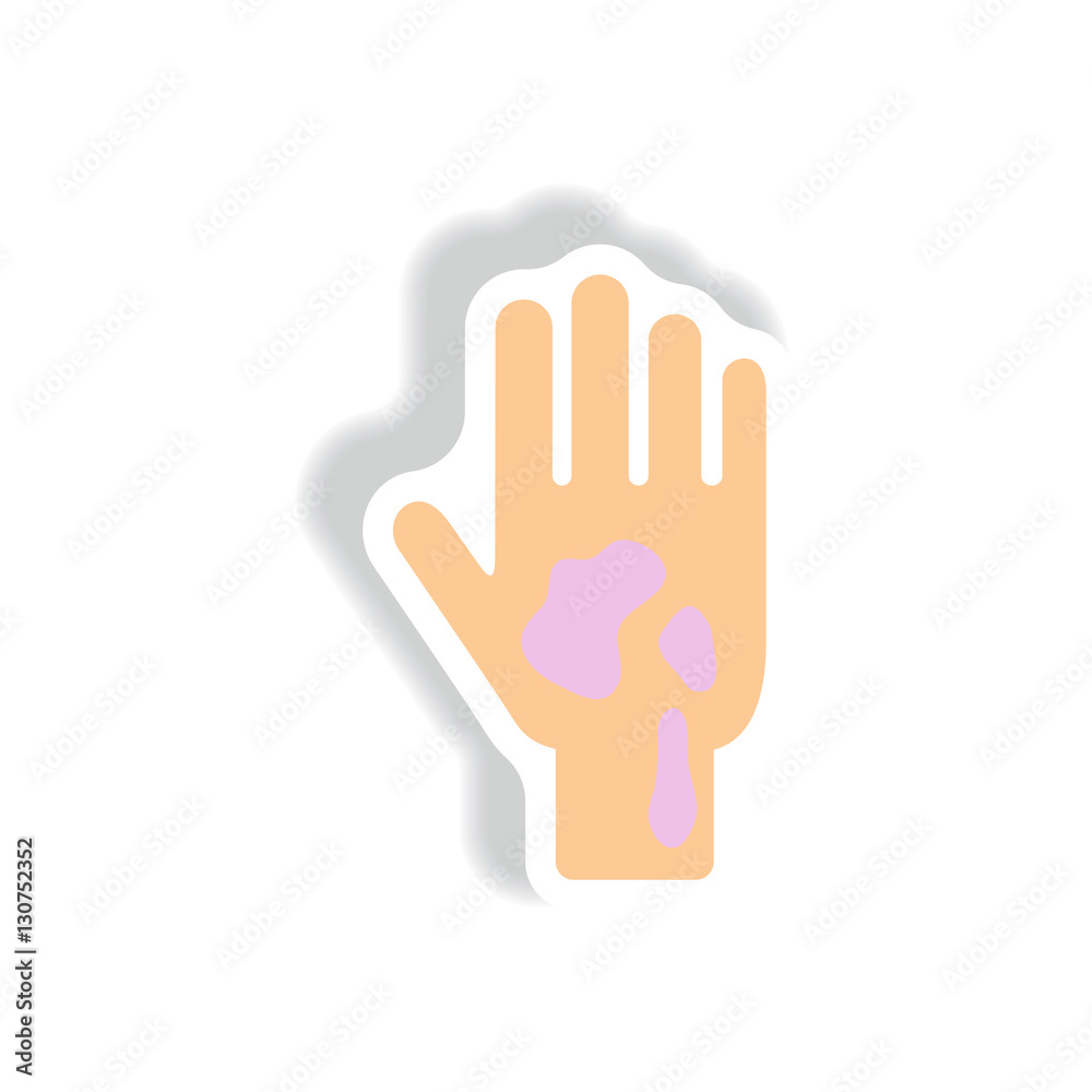 allergic stains on hand Vector paper sticker various symptoms of Malaria on the human allergic stains on hand Vector paper sticker various symptoms of Malaria on the human
