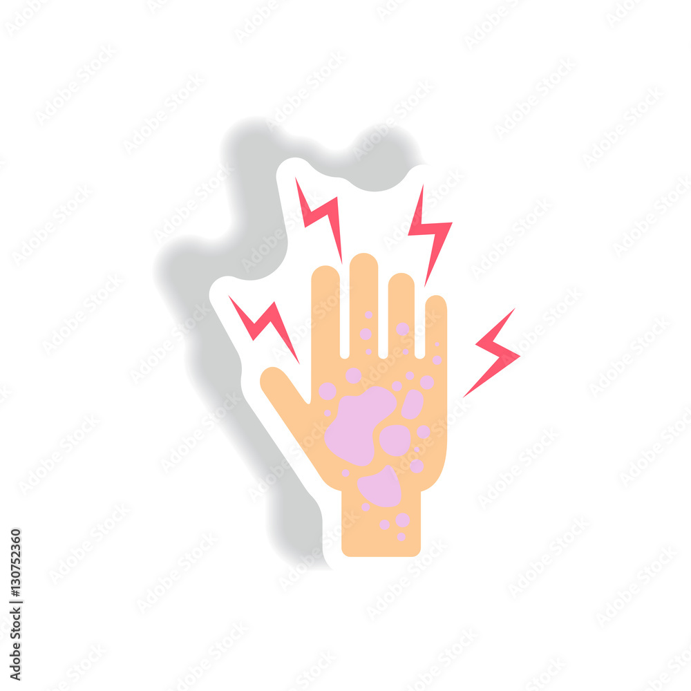 Dermatological effects on hand Vector paper sticker various symptoms of Malaria on the human Dermatological effects on hand Vector paper sticker various symptoms of Malaria on the human