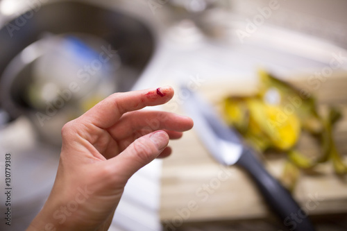 Ouch! Woman cut her finger while cooking a dinner in her kitchen.